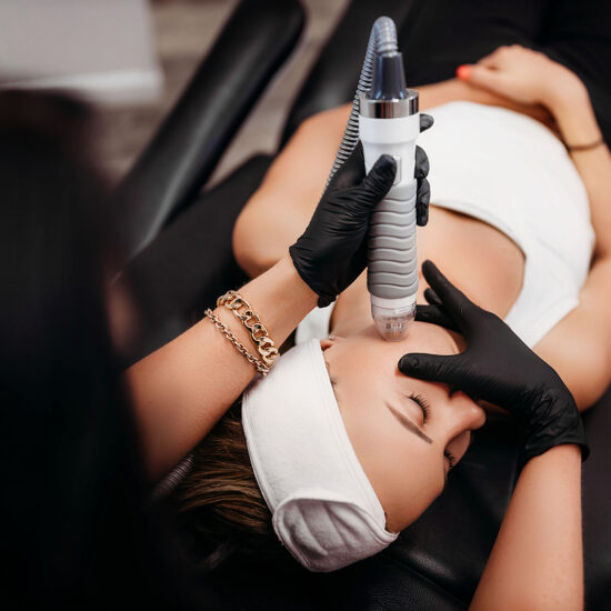 VIVACE RF Microneedling
