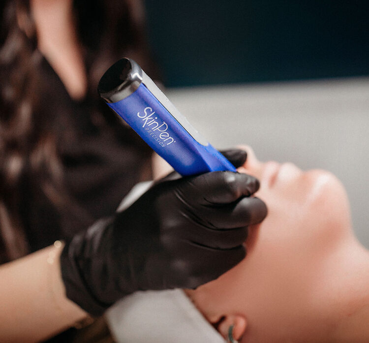 SkinPen Microneedling - Single Treatment