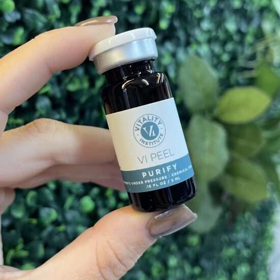 VI Peel - Single Treatment