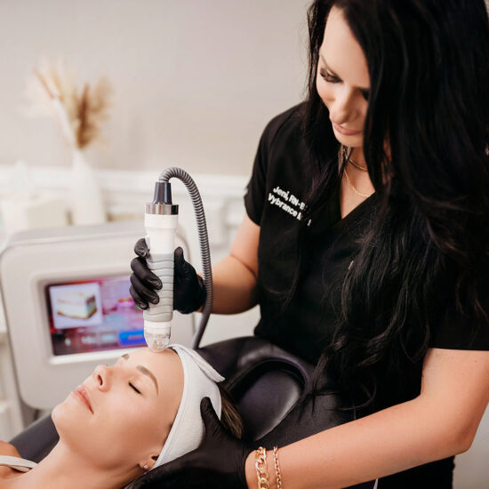 VIVACE RF Microneedling