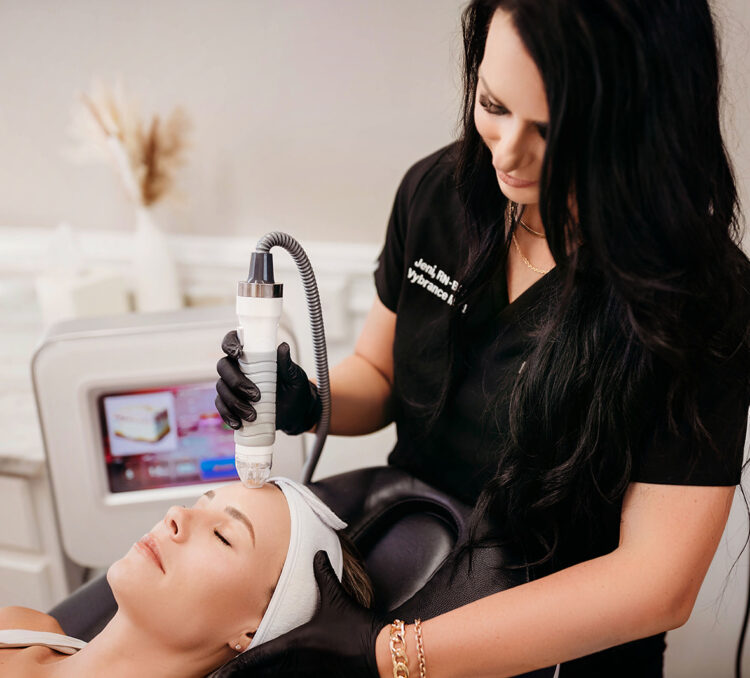 VIVACE RF Microneedling